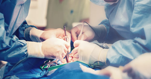 heart surgery in process