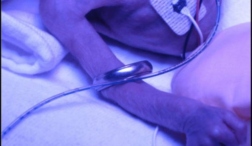 Twins’ stay in NICU has lasting impact