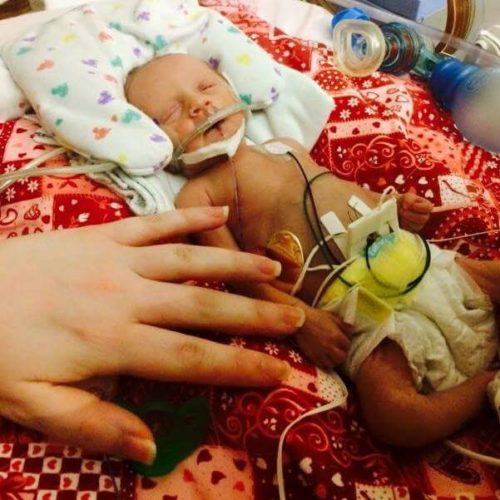 NICU Gives Parents Confidence to Care for Premature Baby