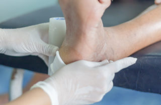 diabetic foot check