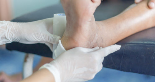 diabetic foot check