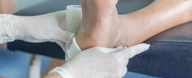 diabetic foot check