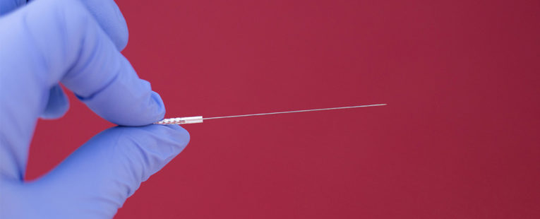 dry needles