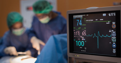 heart transplant team in operating room