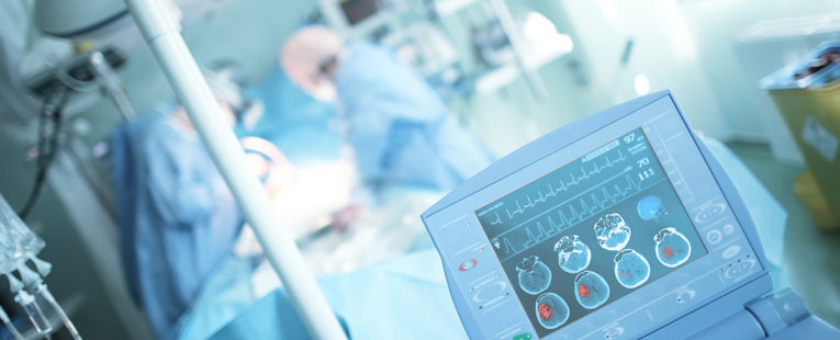 physicians treating a stroke patient in a hospital operating room