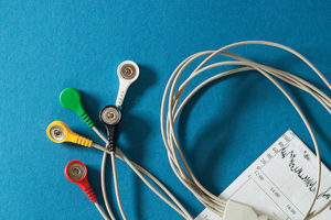 EKG monitor for adult congenital heart patient