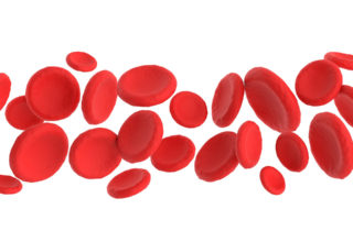 example of blood vessels in patient with vascular disease