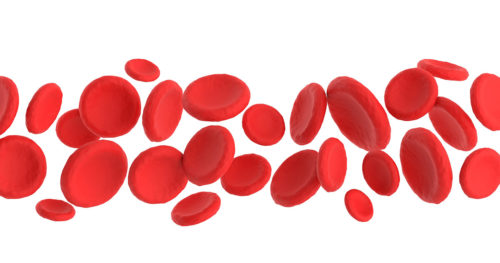 example of blood vessels in patient with vascular disease