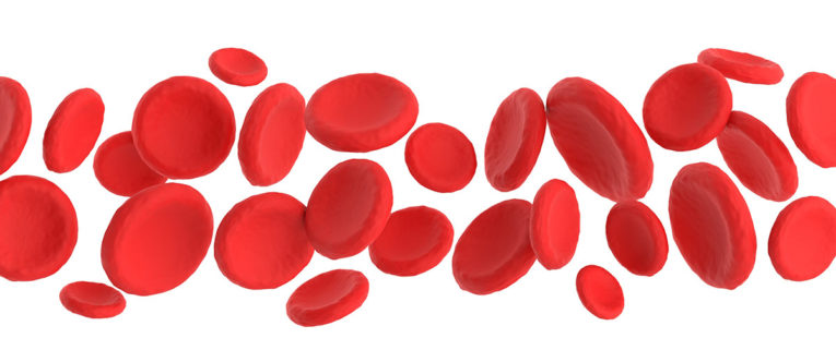 example of blood vessels in patient with vascular disease