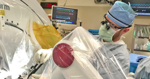 ROSA Robot in use during neurosurgery