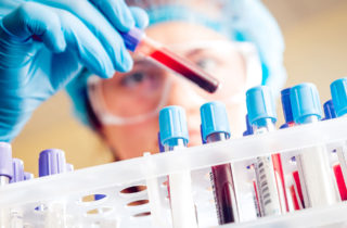 Lab worker placing vial of blood into a rack.
