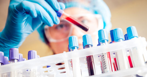 Lab worker placing vial of blood into a rack.
