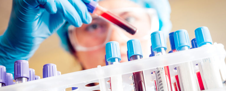 Lab worker placing vial of blood into a rack.