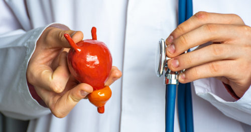 doctor holds a model of a urinary tract