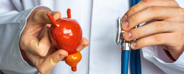 doctor holds a model of a urinary tract