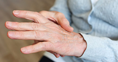 Person holding one hand in the other as though experiencing arthritis pain