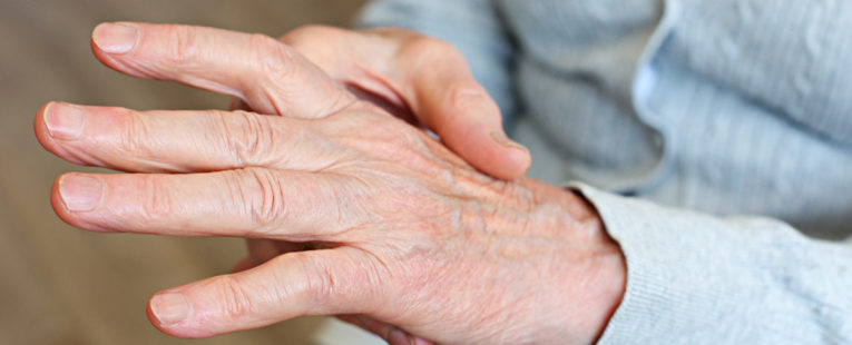 Person holding one hand in the other as though experiencing arthritis pain