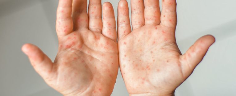 a pair of children's hands palms up
