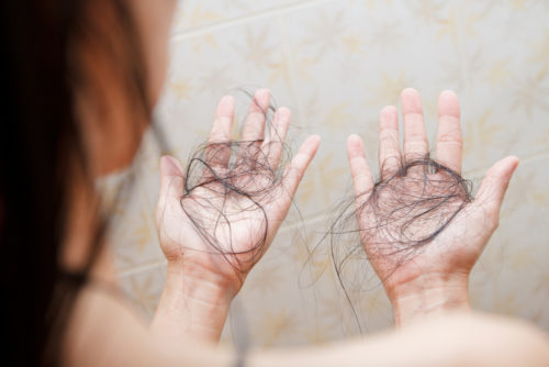 Why is my hair falling out?