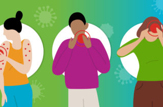 Three female figures depict various symptoms of monkeypox