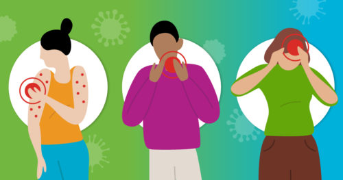 Three female figures depict various symptoms of monkeypox