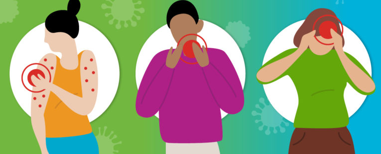 Three female figures depict various symptoms of monkeypox