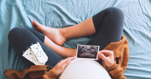 pregnant woman looking at ultrasound trimester