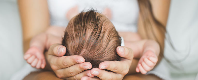 mom holding baby's head, cradle cap, infant hygiene