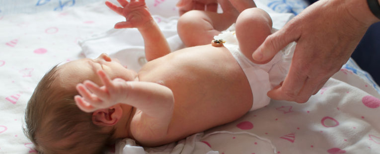 babys umbilical cord, newborn baby, umbilical cord