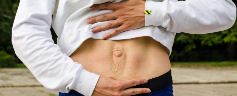 diastasis recti, diastasis recti exercises, abdominal separation